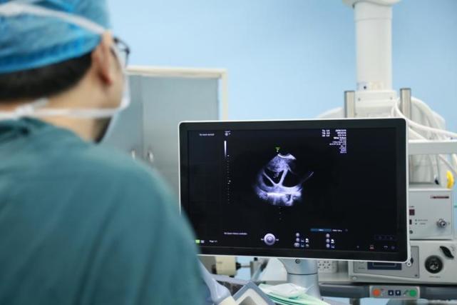 减胎前b超影像多胎妊娠减胎术为安全"减胎"为生命护航考虑到三胞胎