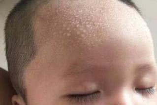 孩子身体有2个部位变臭,说明脾胃不好,常