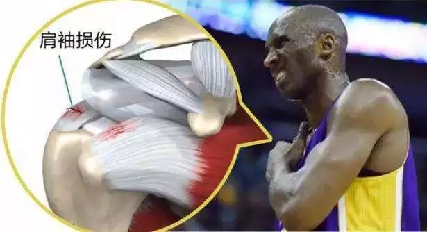 篮球运动中的常见损伤