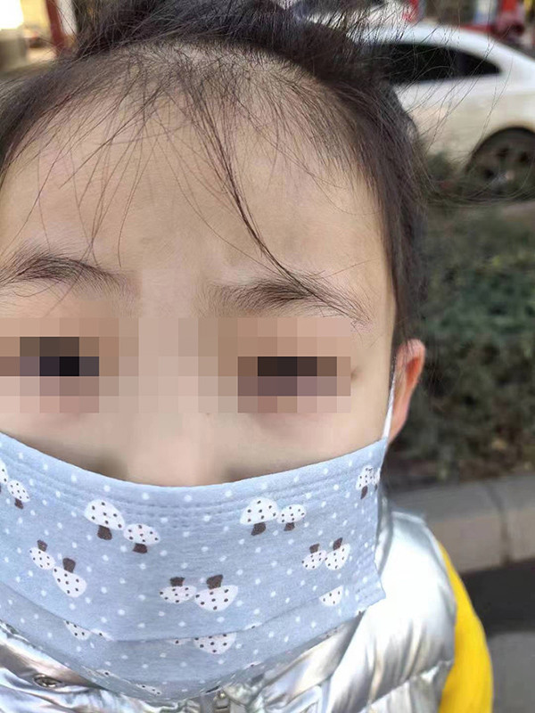 "女童眼睛被塞几十片纸"疑云:无法用科学解释的"恶作剧"