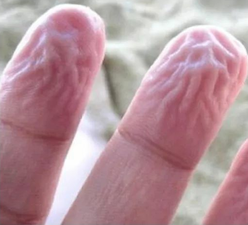 什么是水合我们的皮肤是否会过度水合又会有哪些伤害呢