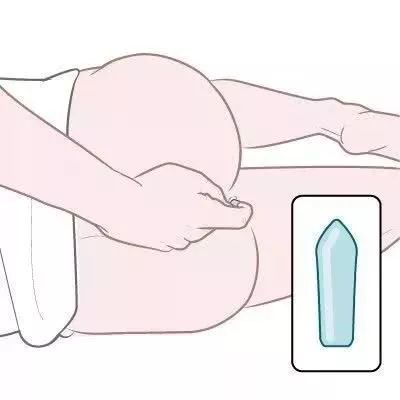 温州一女子做灌肠保养当场腹痛，半月后发现肠道穿孔……插图(3)