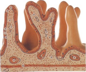 萎缩越严重,肠化就越严重?