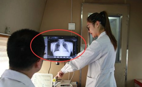 做胸透需要注意什么?