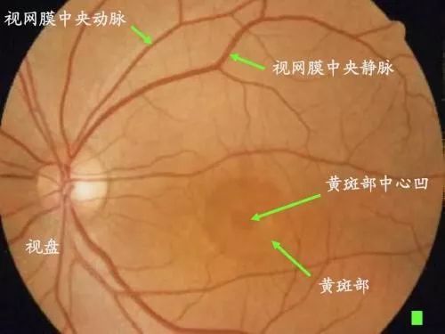 视网膜的一个重要血液供应系统就是视网膜动静脉系统,视网膜中央动脉