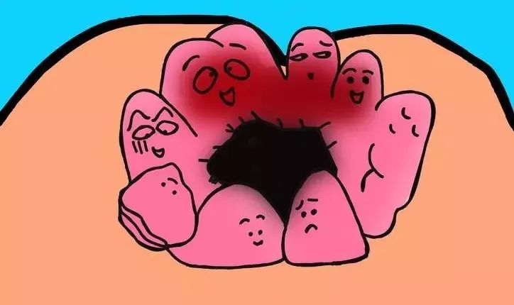 痔疮是怎么样子,痔疮是什么样子的图片