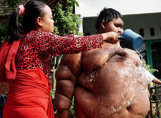 印尼最胖励志男孩2年减掉200斤减肥后的样子让人太震惊了