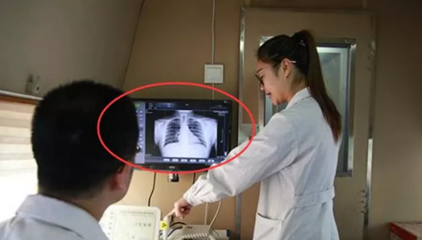 胸片怎么拍 腾讯网