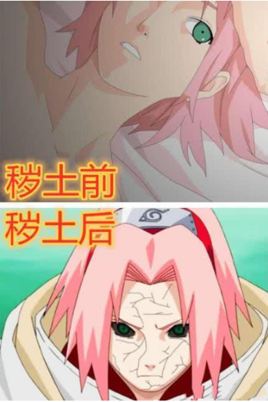火影秽土转生前vs后,小樱意外撞脸迪达拉,看见雏田后女神毁了!