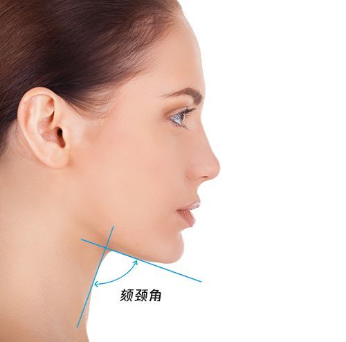 以上四个因素共同造成了颏颈角(也就是下巴和脖子交界角)变钝,于是