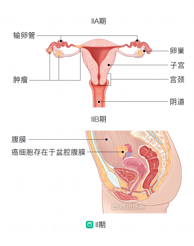 女人子宫平面图图片