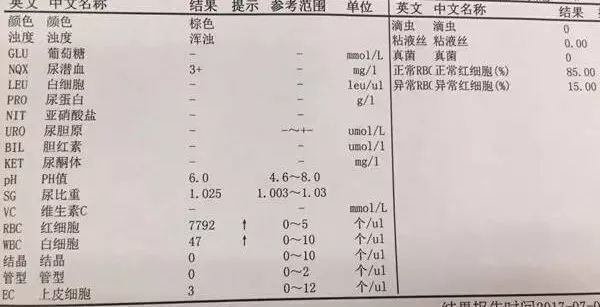 体检报告中这一项很不起眼 连医生有时也会忽视 腾讯新闻