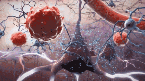 脐迹|脐血治疗中风,台湾一男子完全康复|细胞|脑卒中|单核细胞|脐带血