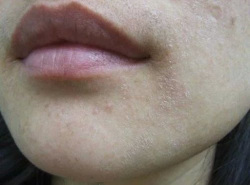 皮肤干燥起皮?诀窍你get了么