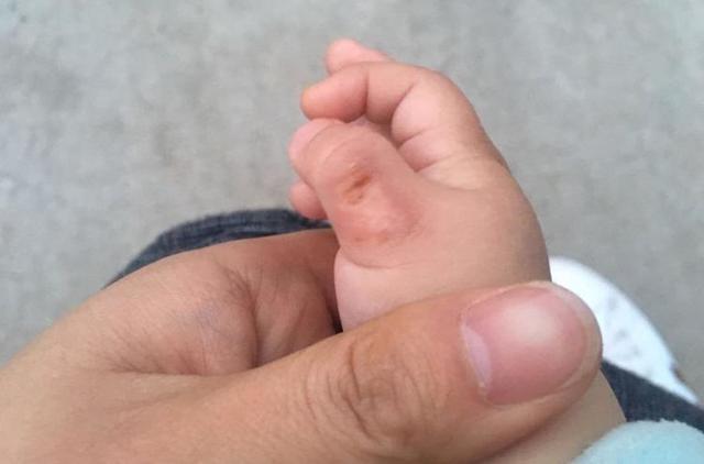 吃手的孩子"聪明"?除了不卫生,还有可能影响牙齿发育