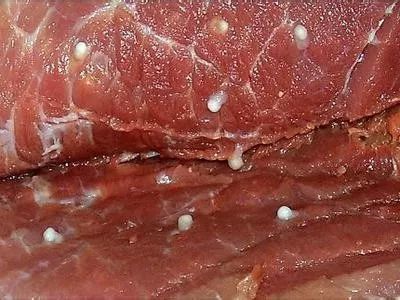 (猪肉上的猪囊尾蚴虫卵)11月27日,经过手术,医生从朱先生的体内挖出了