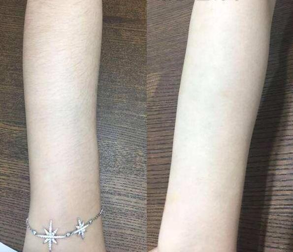 g刮完腿毛涂身体乳刺痛(为什么涂完身体乳腿上有刺痛感)