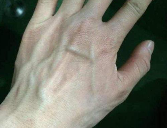 青筋突出 腾讯网