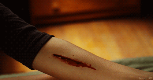 在伤口上撒盐会疼那么撒糖呢