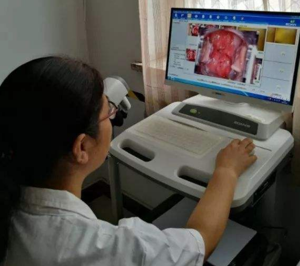 妇科:不是感染hpv就得做阴道镜 活检,做不做要根据这个结果决定