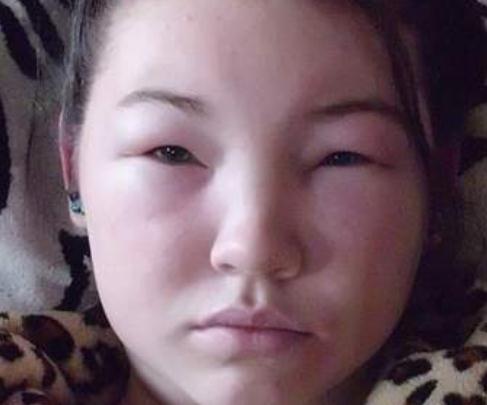 肺癌并非突如其来一旦身体出现这3种现象需要提高警惕了