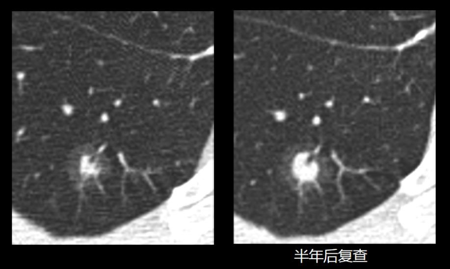 广西医学影像诊断中心：精准诊断的新标杆