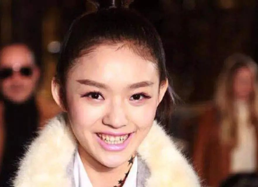 当然也有牙齿保护得好的正面例子,比如刘雯