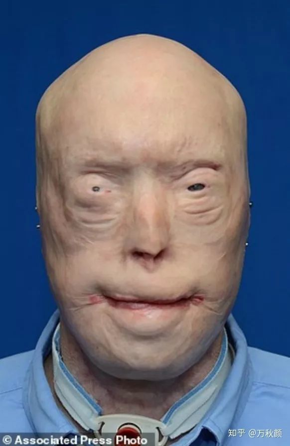 网红脸不算什么,他才是"整容的极限"