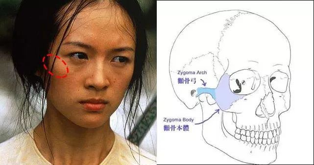 除了颧骨平颧弓突,还有一点就是瘦.