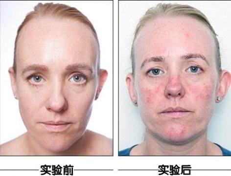 不洗脸反而皮肤更好外国人亲测一个月不洗脸皮肤变成这样