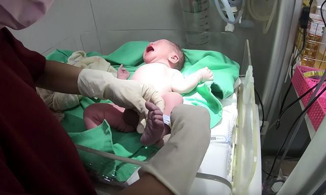 26岁孕妇生娃老公拍下全过程六张过程图告诉你生命诞生过程