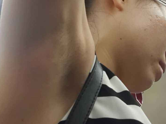 为何有的女孩子腋下不长毛90是这3原因看完一定都不羡慕