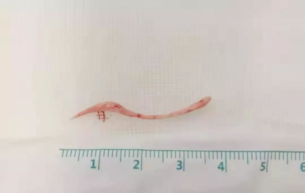 武汉大学人民医院|10个科室30位专家齐上阵，死里逃生大抢救，急诊科主任提醒千万小心！