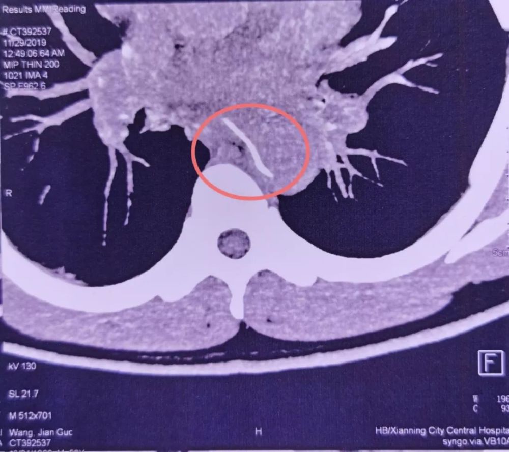 武汉大学人民医院|10个科室30位专家齐上阵，死里逃生大抢救，急诊科主任提醒千万小心！