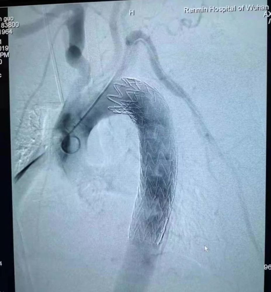 武汉大学人民医院|10个科室30位专家齐上阵，死里逃生大抢救，急诊科主任提醒千万小心！
