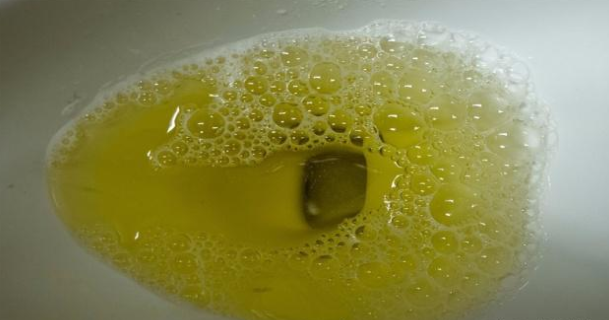 金银花茶尿液图片