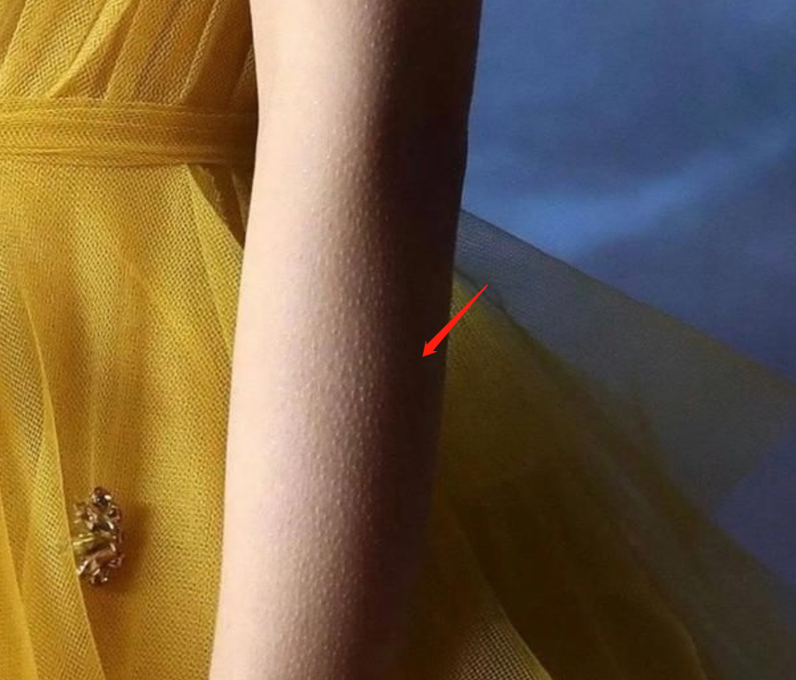 冻得起鸡皮疙瘩是什么病(一冷就起鸡皮疙瘩是什么原因)