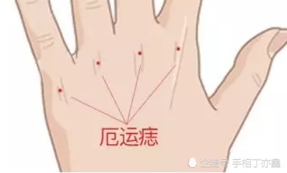 手背上有痣的人 一定大富大贵吗 腾讯新闻