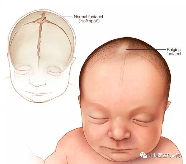 家喻户晓!婴儿囟门位置图详解"一往无前"-第1张图片-西安论坛资讯