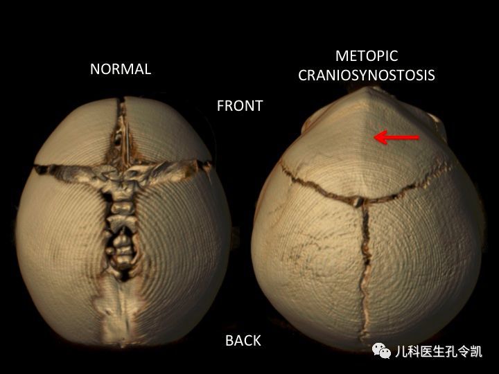 评论!婴儿天灵盖为什么没有闭合"育婴技术"-第2张图片-克子博客