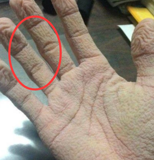 为什么手指长时间浸水会变皱,是暗示什么?或许看完你就明白了