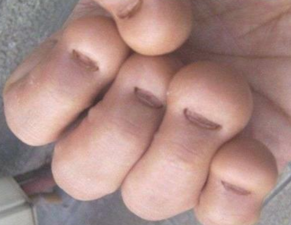 经常咬指甲的人,可能源于这3个"本能反应",别被蒙在鼓里!_腾讯新闻