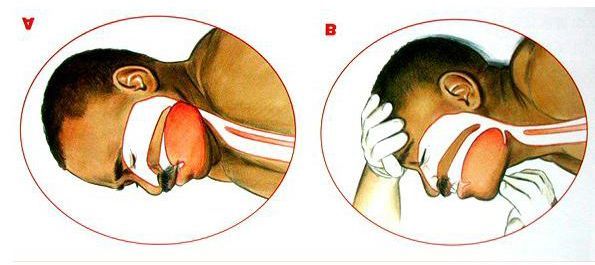 这份急救指南收好!熟读能救人一命