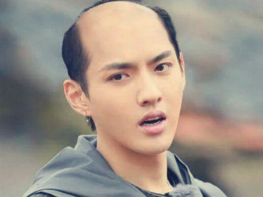 就怕明星地中海躲过了胡歌逃过了吴亦凡却被王俊凯气哭