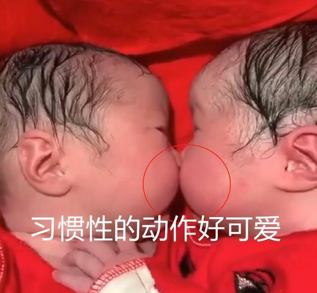 孩子@龙凤胎兄妹刚出生就一直亲，分都分不开，网友：上辈子一定是爱人