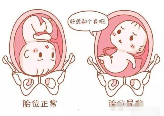 胎儿的头为什么是朝下的,胎儿坐着不是更舒服吗?别再无知了!