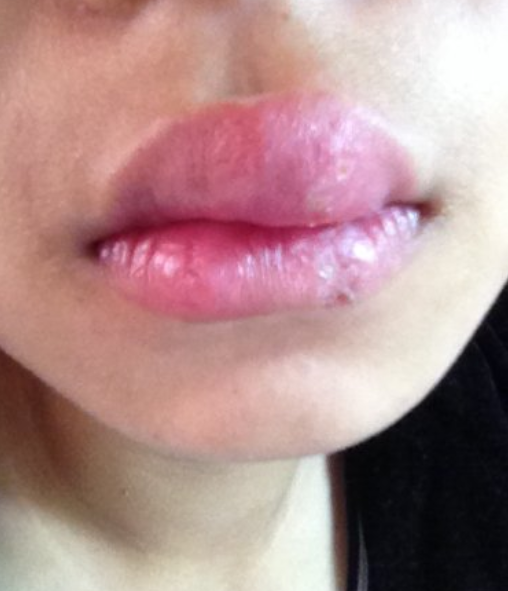 "妇科有疾"的女生,嘴巴或会发出这"3声音",希望你一个不占