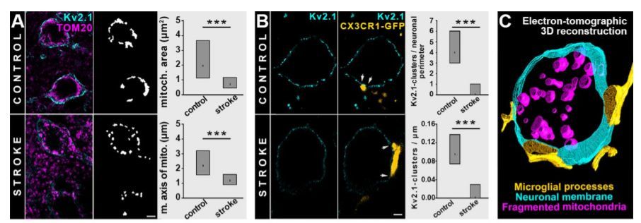 Science 改写教科书 科学家可能找到新型突触结构 腾讯新闻