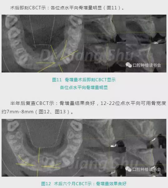 人物有约丨修己惠人，笃行致远——大众口腔种植专家蒋澍