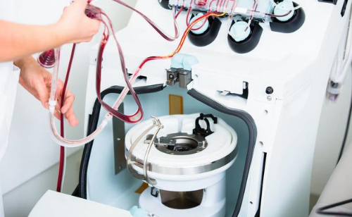 高血脂能通过抽血换血来解决吗?辟谣:这种方法有,但不是首选